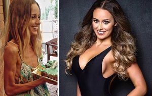 Анорексия, болестта на отличничките- разбирайте, помагайте, не вредете